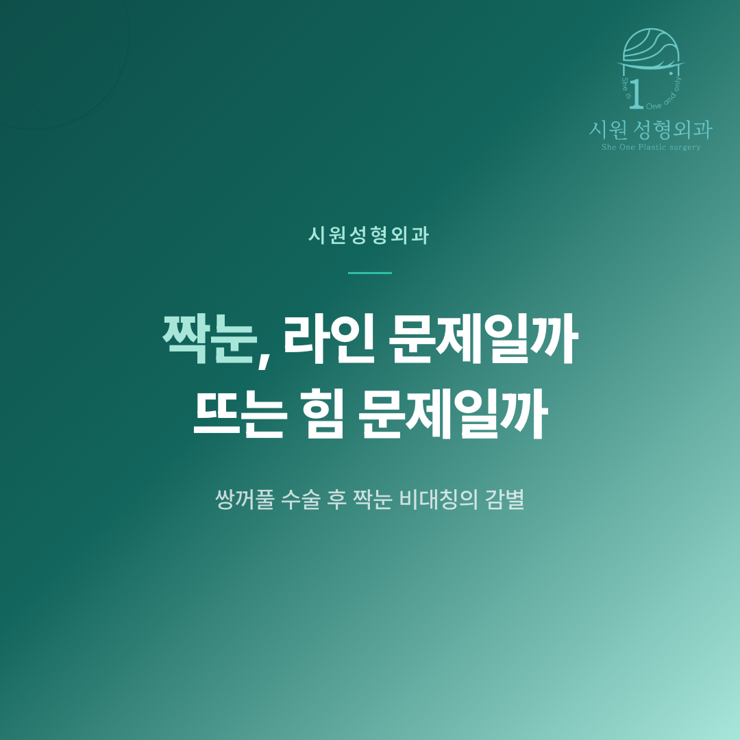 쌍꺼풀 수술 후 짝눈 비대칭의 원인을 감별하는 기준을 안내하는 대표 이미지