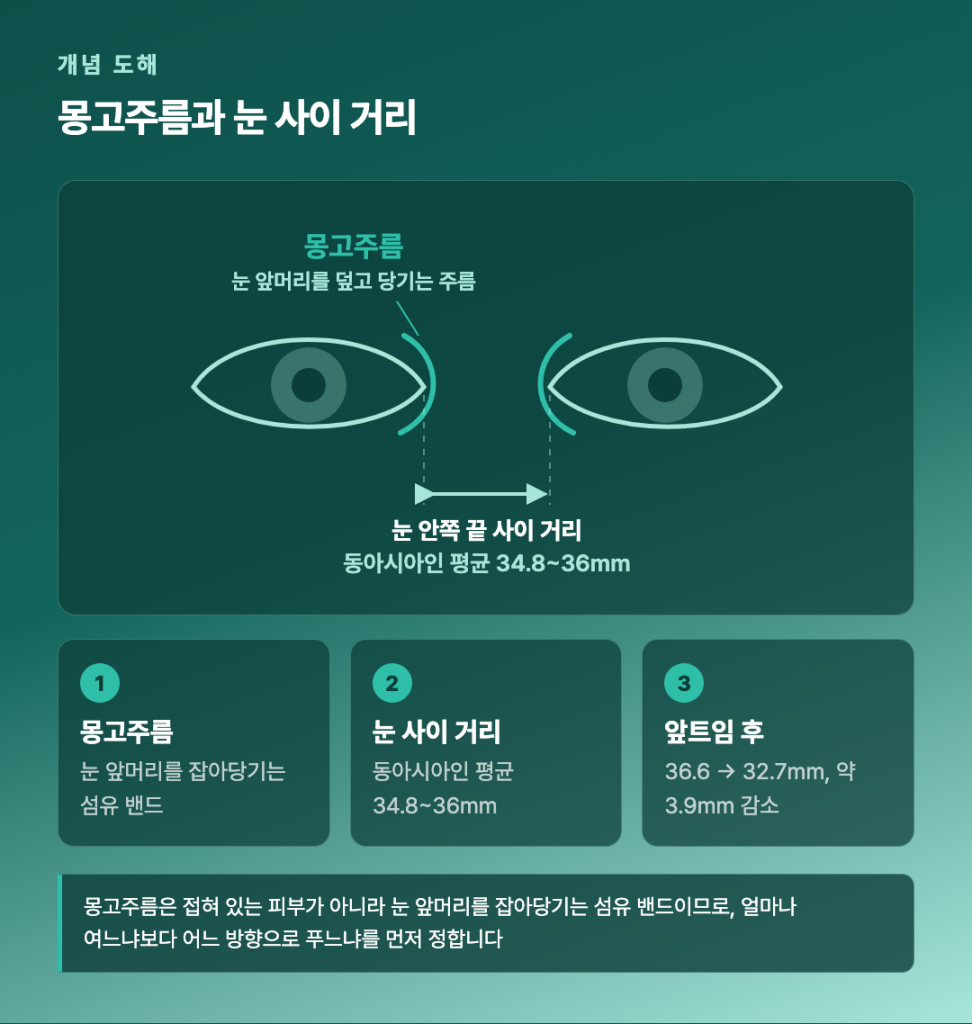 몽고주름과 눈 사이 거리 개념