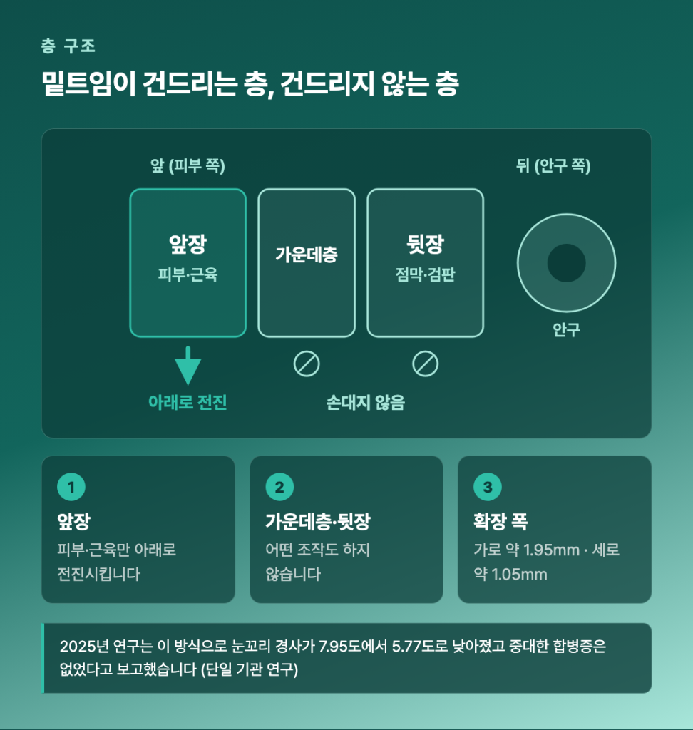 눈꺼풀 3겹 구조와 밑트임이 조작하는 층