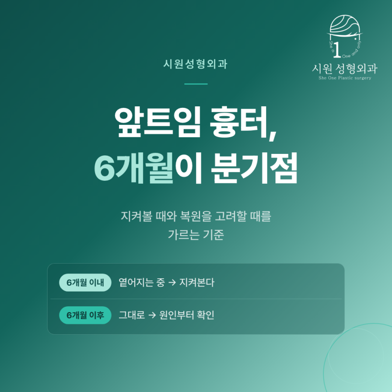 앞트임 흉터 복원 시점을 6개월 기준으로 나눈 안내 이미지
