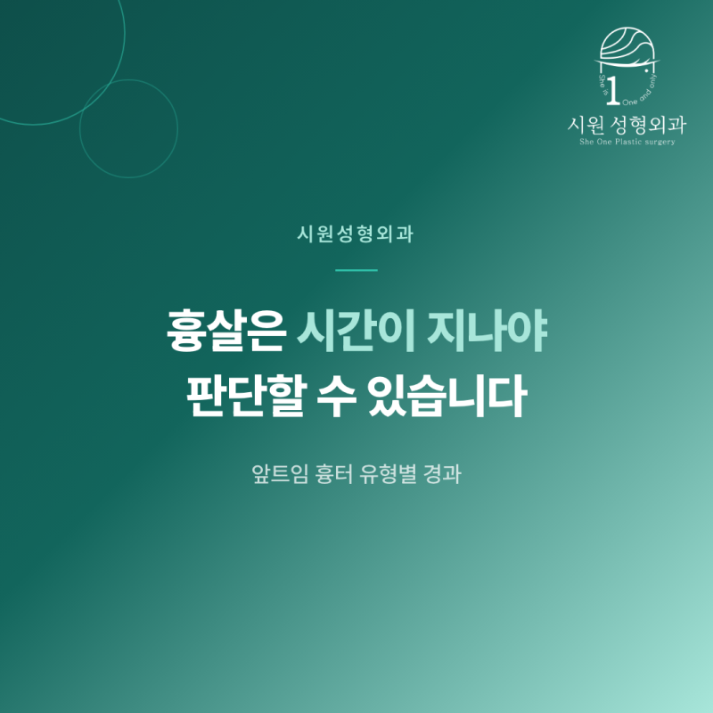 앞트임 흉살이 시기별로 어떻게 달라지는지 안내하는 대표 이미지