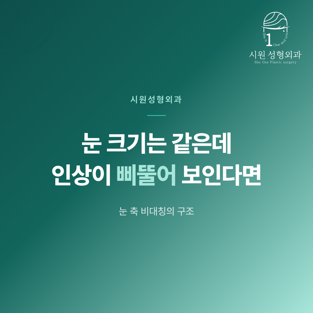눈 축 비대칭의 구조적 원인을 안내하는 대표 이미지