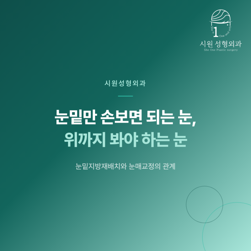 눈밑지방재배치를 눈매교정과 함께 계획해야 하는 경우를 안내하는 대표 이미지