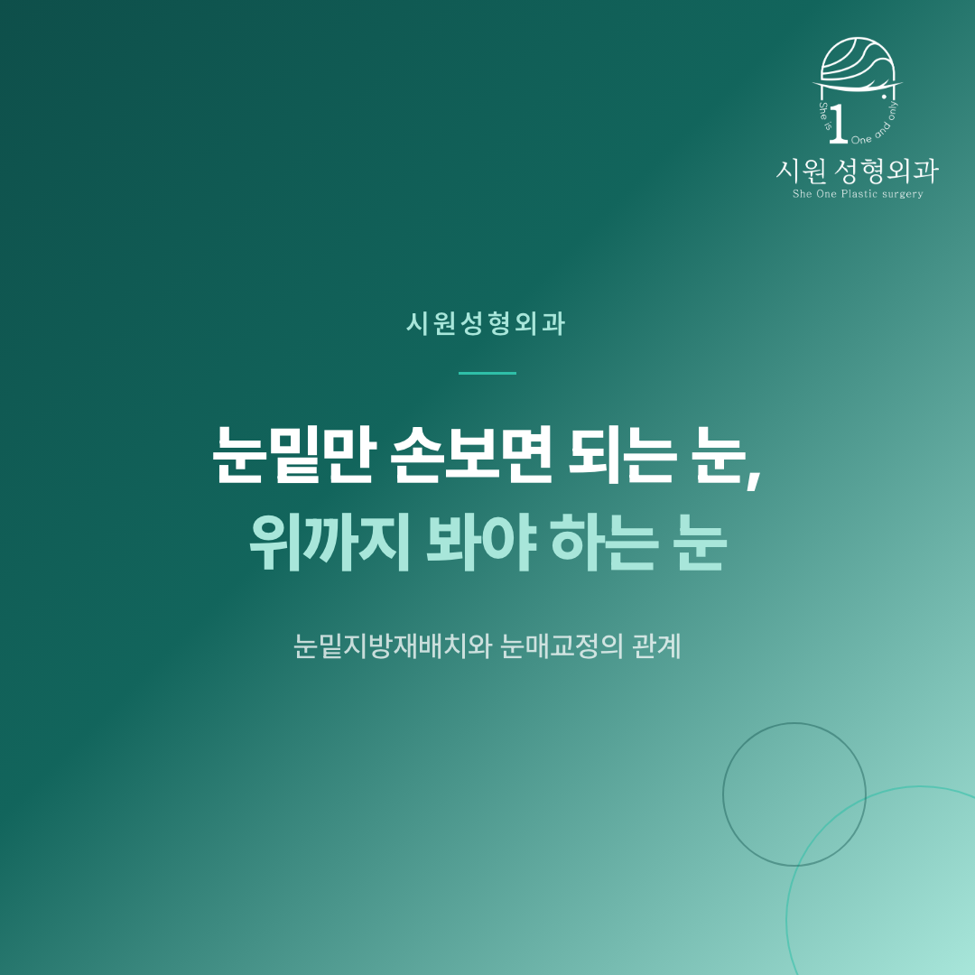 눈밑지방재배치를 눈매교정과 함께 계획해야 하는 경우를 안내하는 대표 이미지
