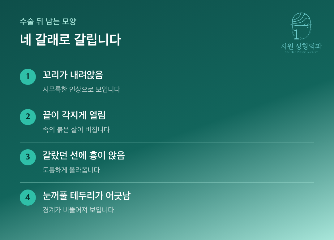 뒤트임 수술 뒤 남는 눈꼬리 모양 네 가지 유형