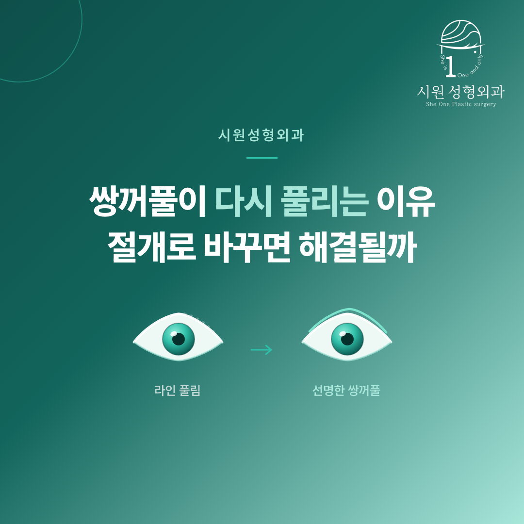 쌍꺼풀이 다시 풀리는 이유를 고정 위치로 설명한 썸네일 이미지