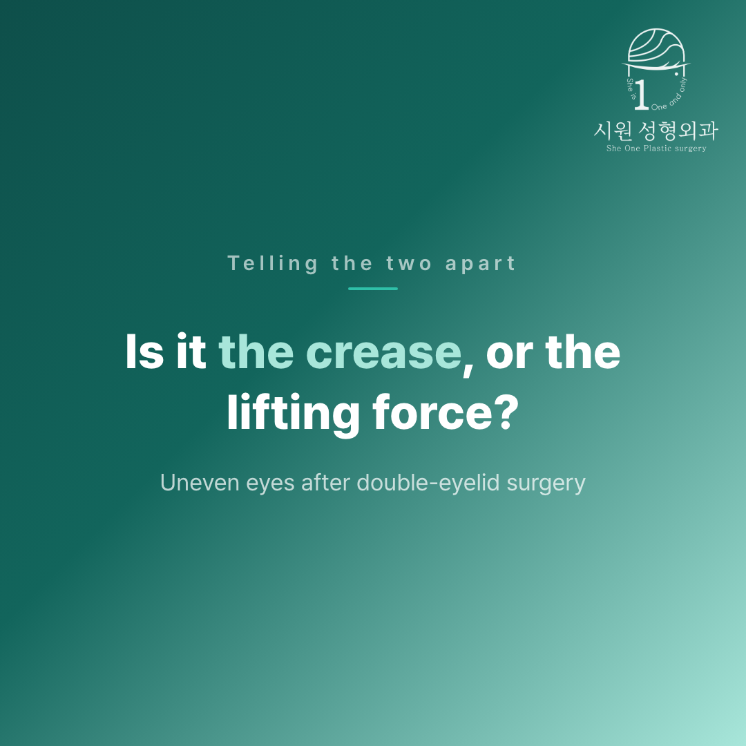 Uneven eyes after double-eyelid surgery: a crease problem or a lifting-force problem