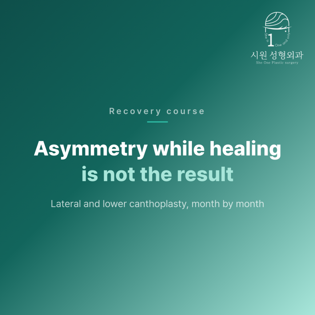 Asymmetry while healing is not the result &mdash; lateral and lower canthoplasty
