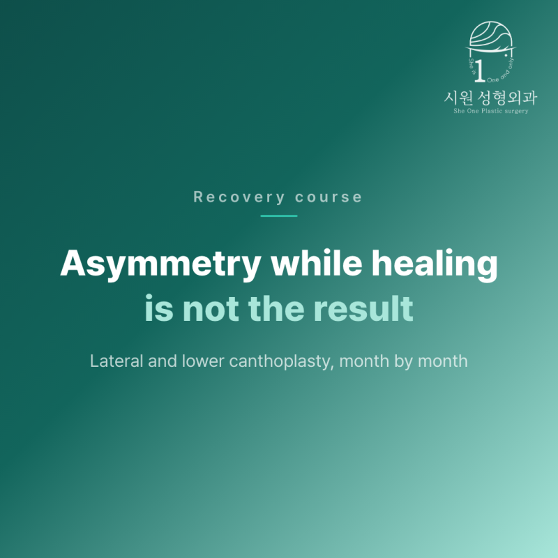 Asymmetry while healing is not the result &mdash; lateral and lower canthoplasty