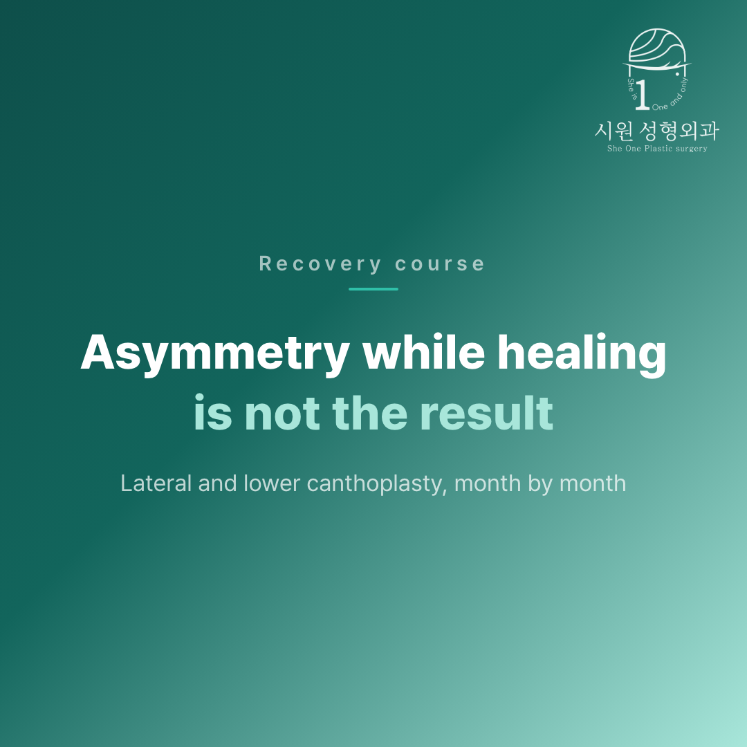 Asymmetry while healing is not the result &mdash; lateral and lower canthoplasty
