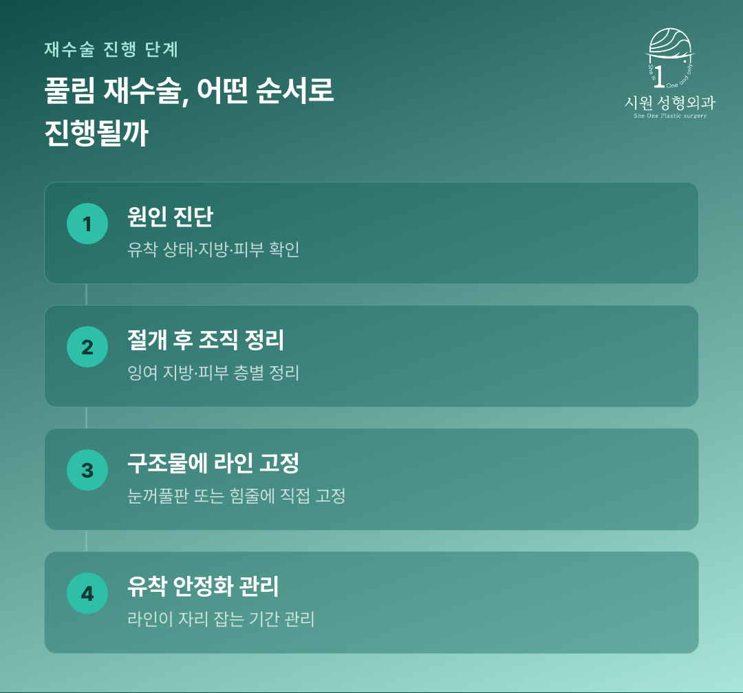 쌍꺼풀 라인 재수술이 진행되는 네 단계를 보여주는 다이어그램
