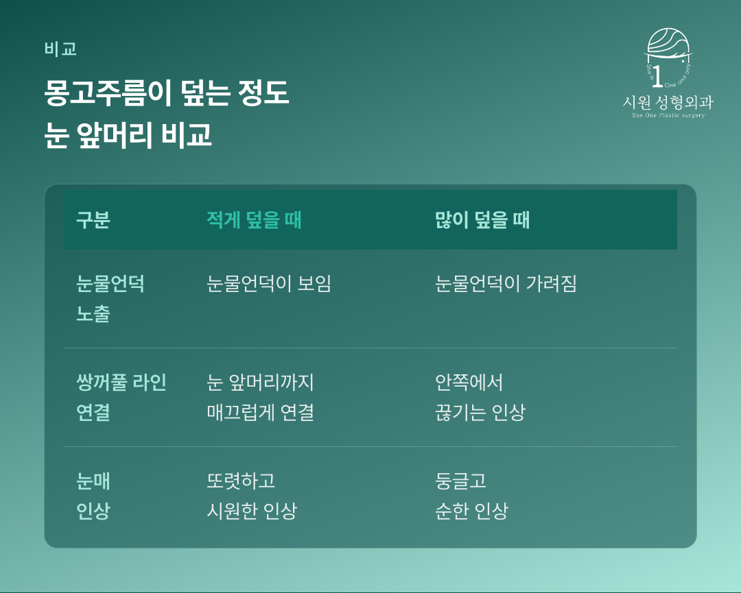 몽고주름이 적게 덮은 눈과 많이 덮은 눈의 눈물언덕 노출 차이를 비교한 그림