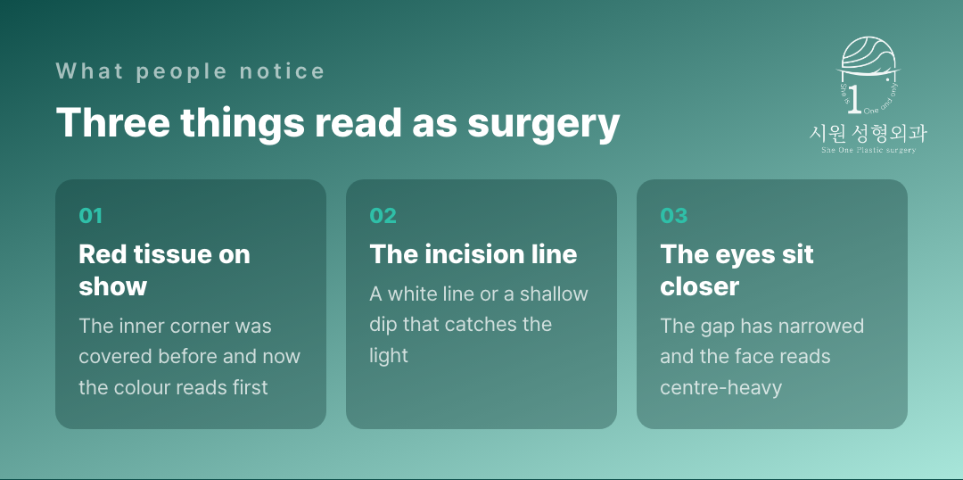 Three things that read as epicanthoplasty surgery