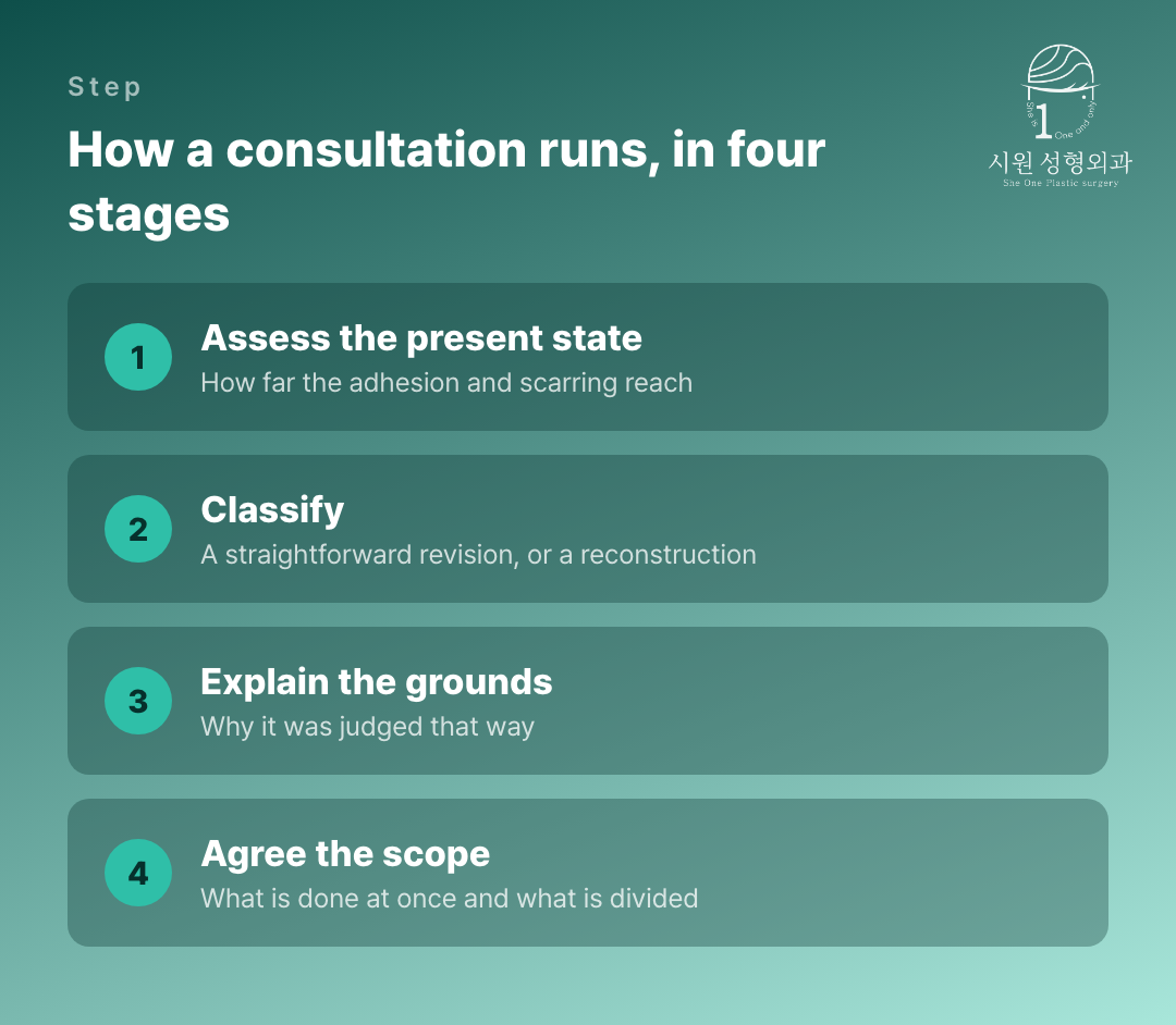 How an epicanthoplasty revision consultation runs, in four stages