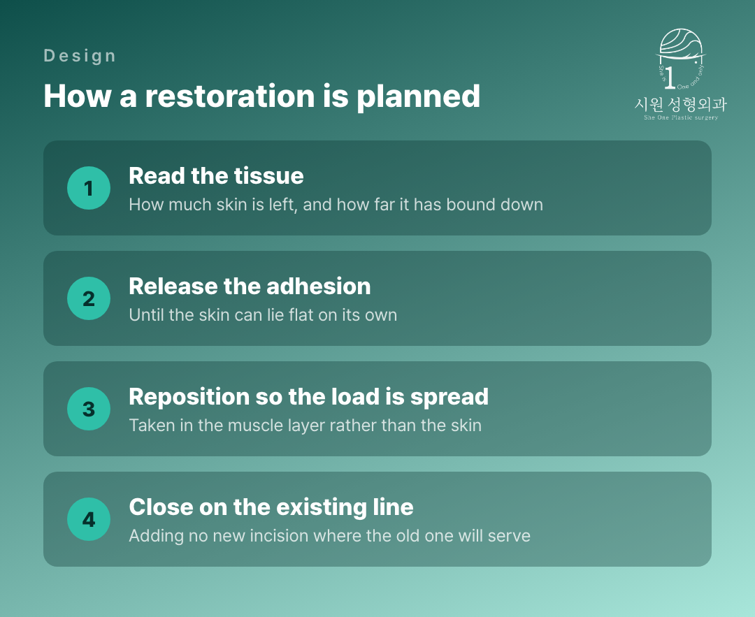The four stages of planning an inner-corner restoration