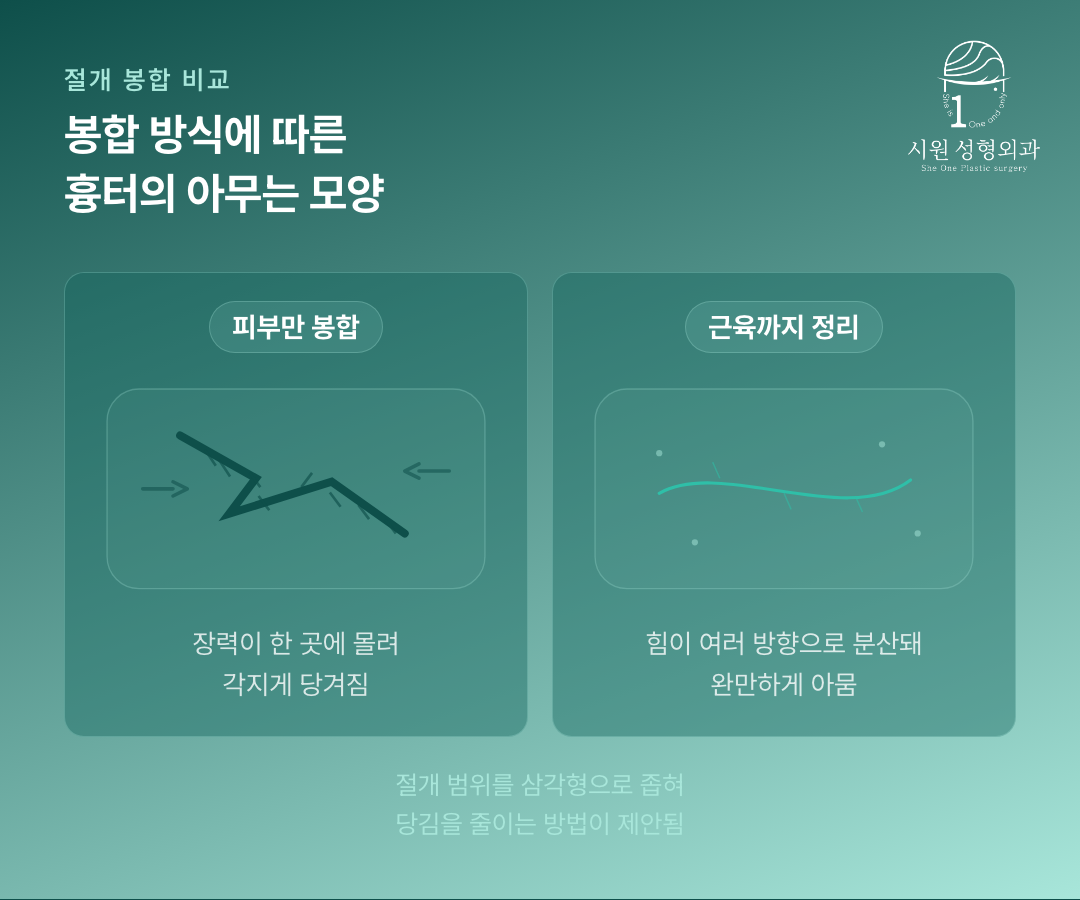 피부만 당긴 봉합과 장력을 분산한 봉합의 흉터 차이를 비교한 그림