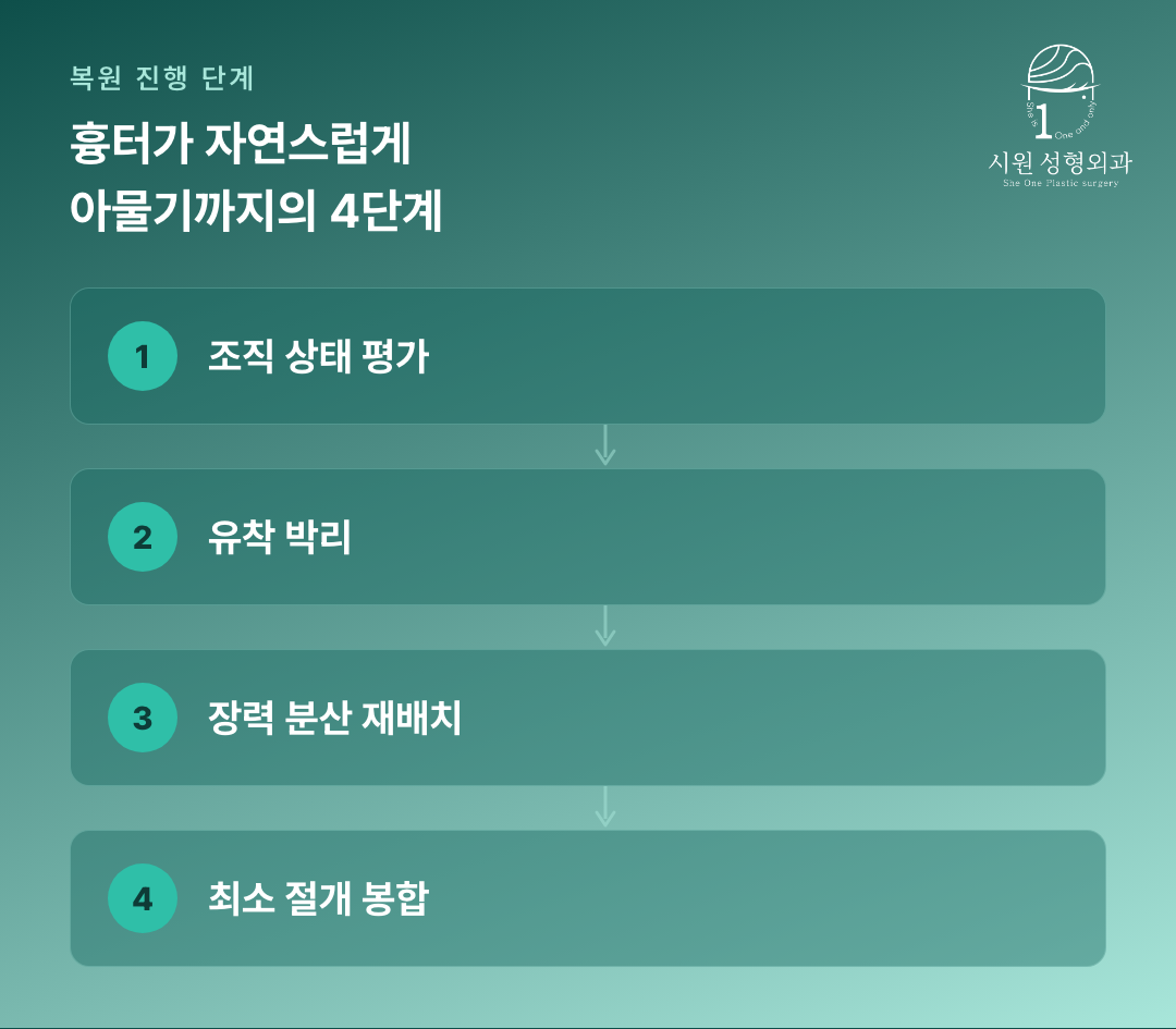 앞트임복원 설계 네 단계를 순서대로 보여주는 다이어그램