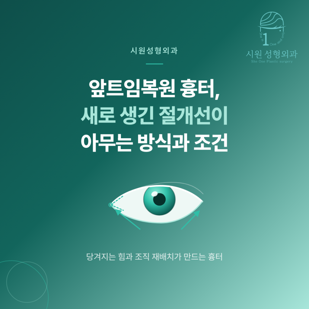 앞트임복원 흉터가 아무는 과정을 보여주는 눈 앞머리 절개선 일러스트