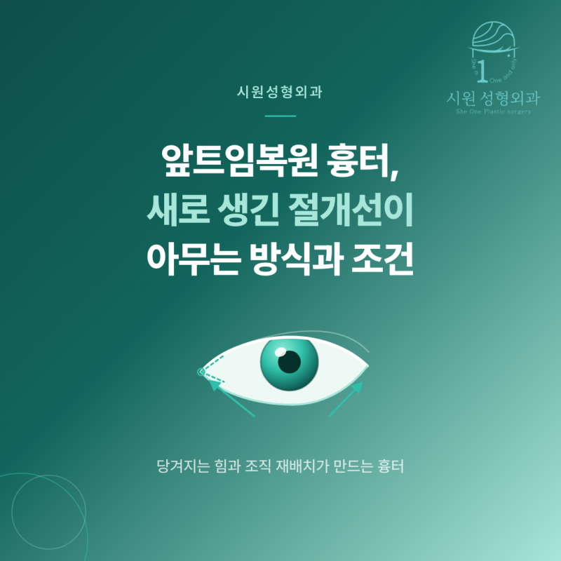 앞트임복원 흉터가 아무는 과정을 보여주는 눈 앞머리 절개선 일러스트