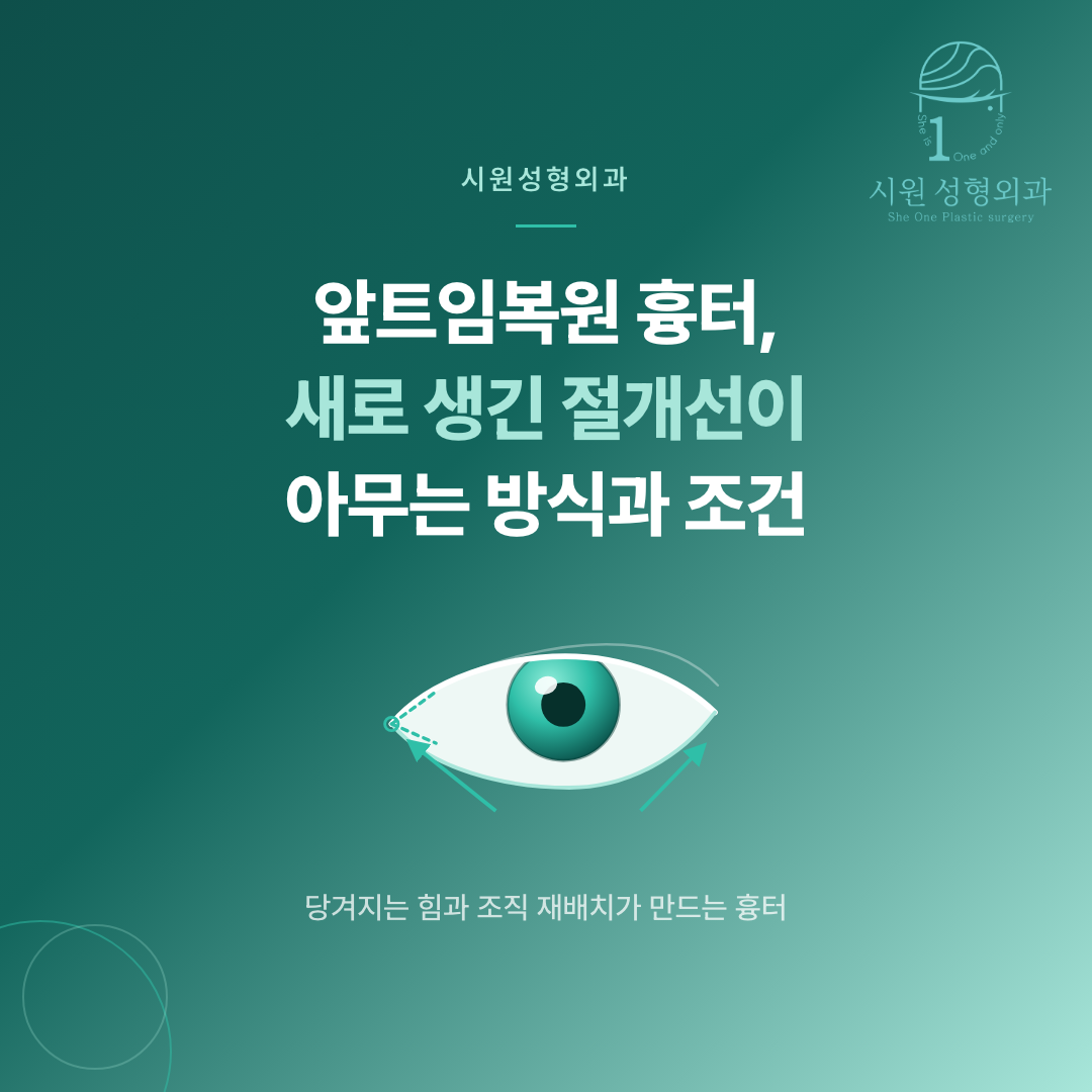 앞트임복원 흉터가 아무는 과정을 보여주는 눈 앞머리 절개선 일러스트