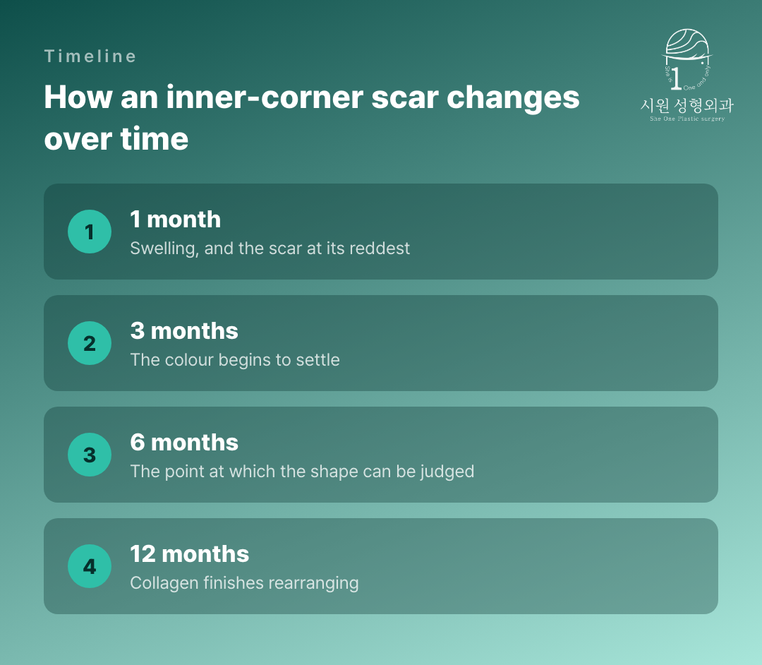 How an inner-corner scar changes at one, three, six and twelve months