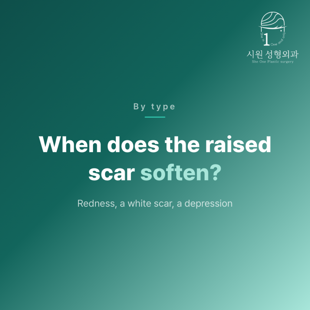 When an epicanthoplasty scar softens, set out by type