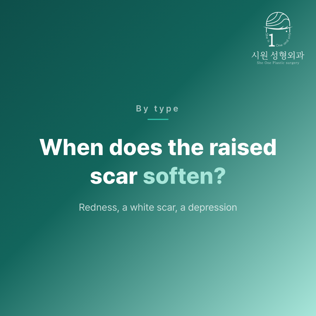 When an epicanthoplasty scar softens, set out by type