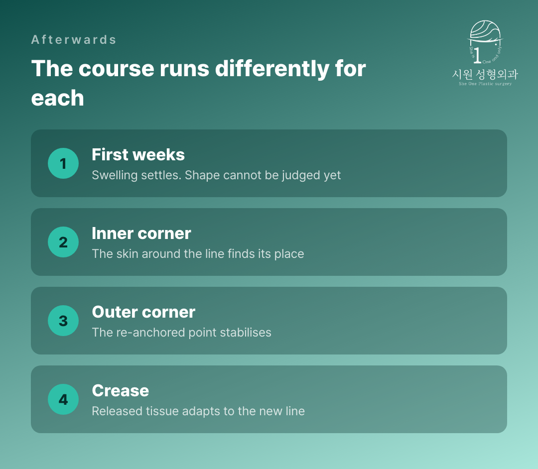 How recovery runs differently after each of the three revisions