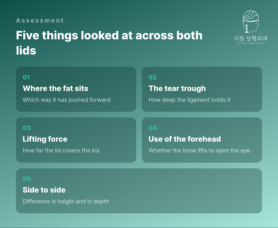 Five things assessed across the lower and upper lid together