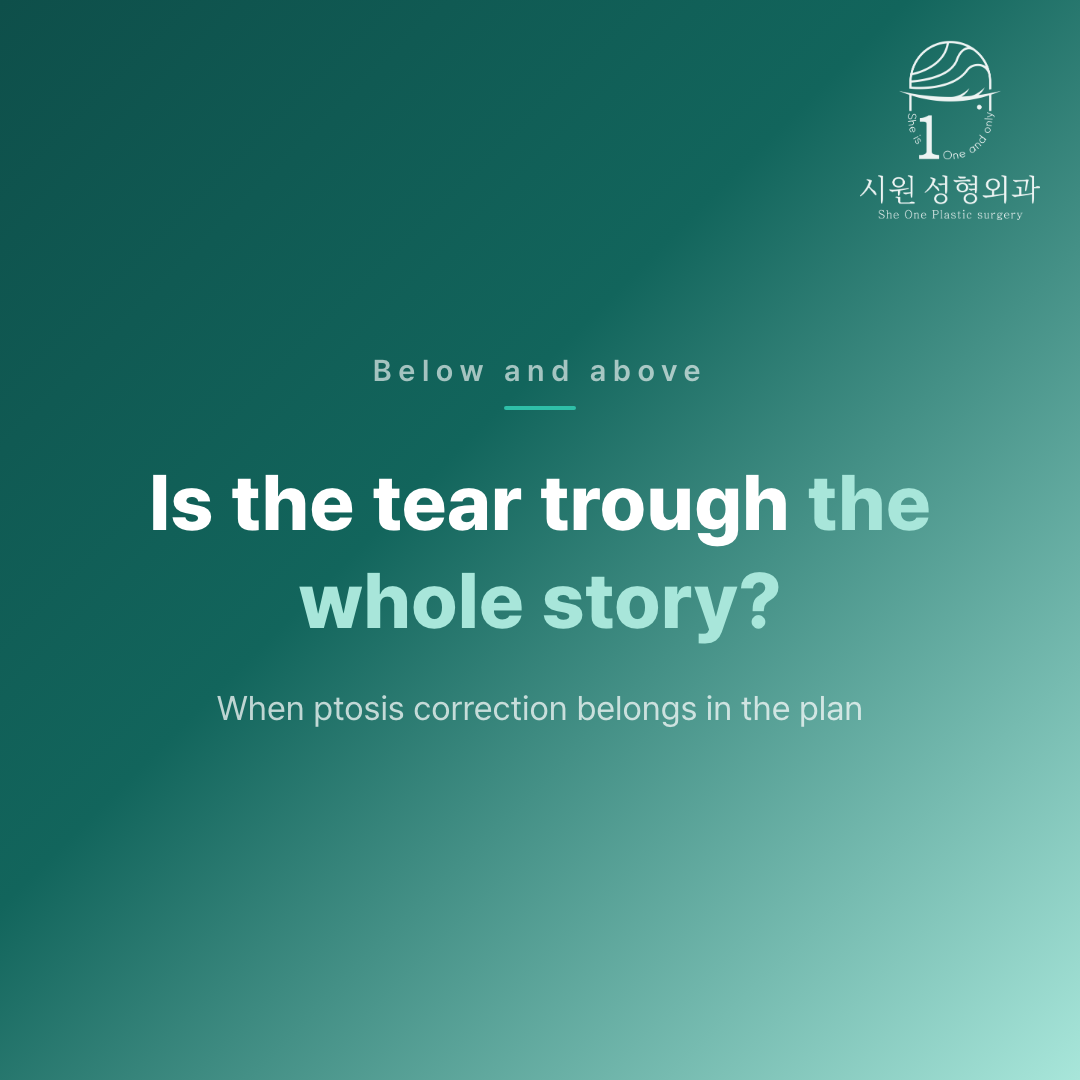 When a tear trough needs ptosis correction looked at alongside