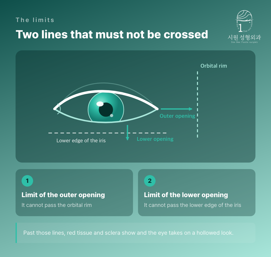 The orbital rim and the lower edge of the iris as the two limits
