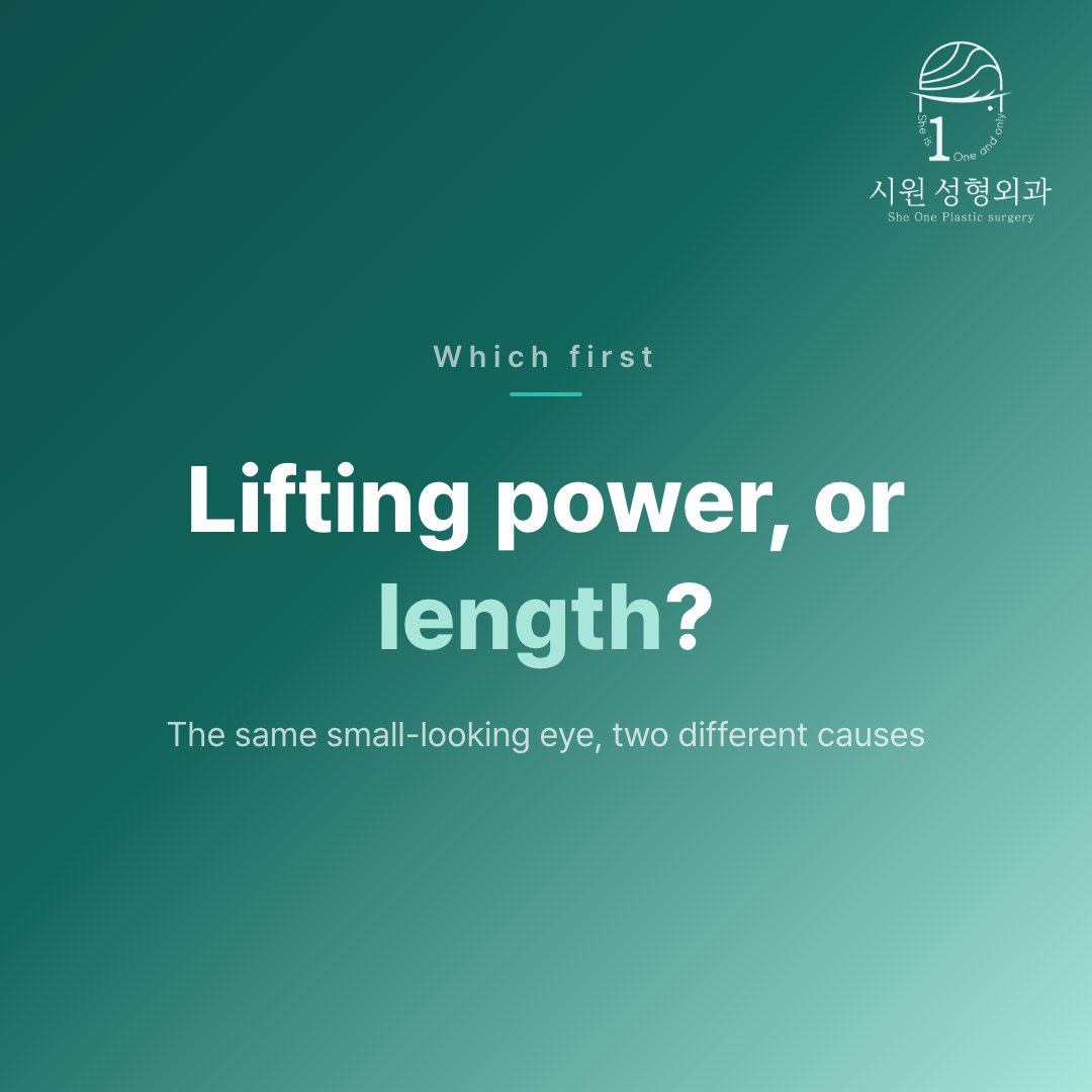 Deciding between lifting power and length before a lower-corner opening