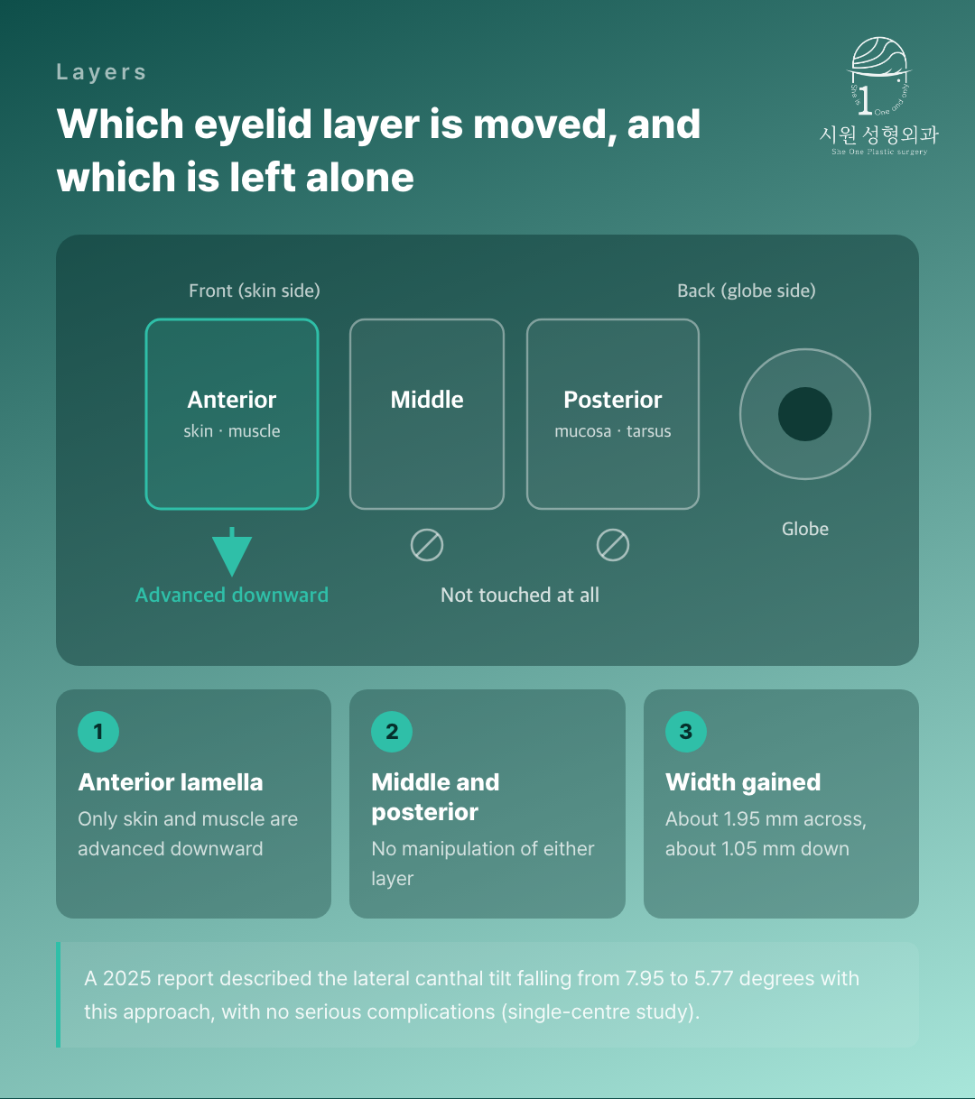 Which eyelid layer is moved and which is left alone