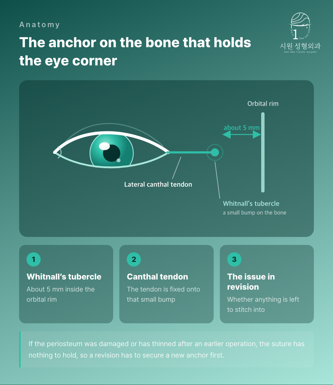 Whitnall's tubercle, the bone anchor for the lateral canthal tendon