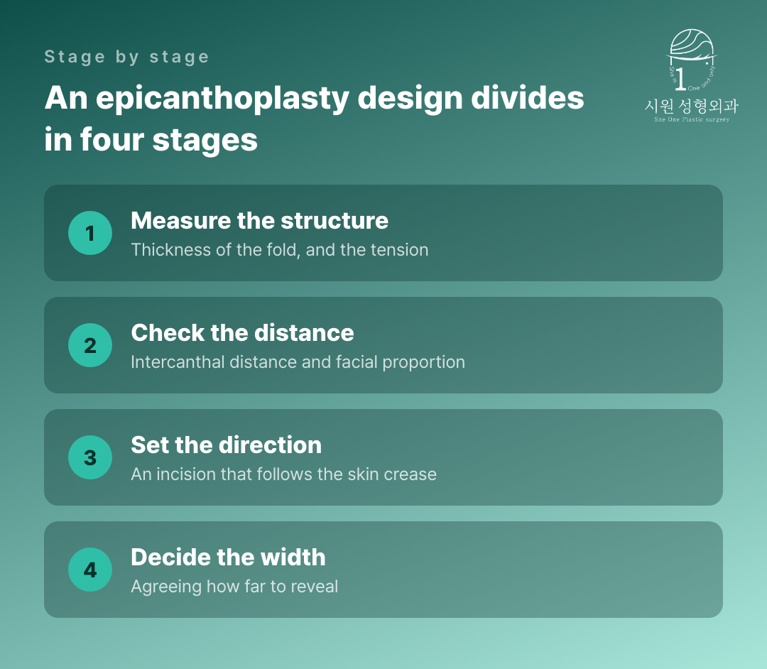 The four stages in which an epicanthoplasty design is decided