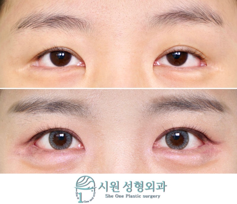 Unevenness from a difference in lifting force, before and after