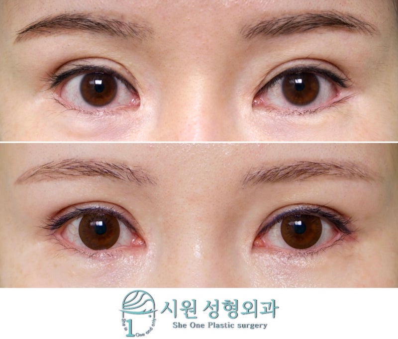 Crease and corner restoration together, before and after