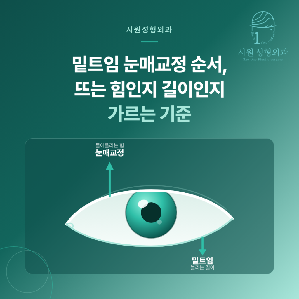 밑트임 눈매교정 순서를 정하기 위해 눈꺼풀 올리는 힘과 눈 길이를 비교하는 그림